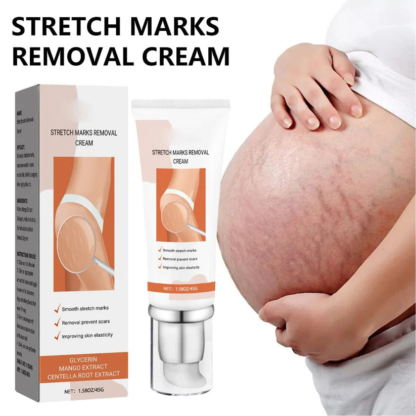 Stretch Marks Removal Repair Cream