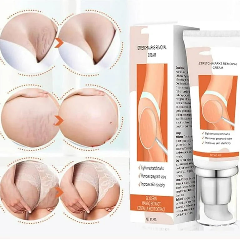 Stretch Marks Removal Repair Cream