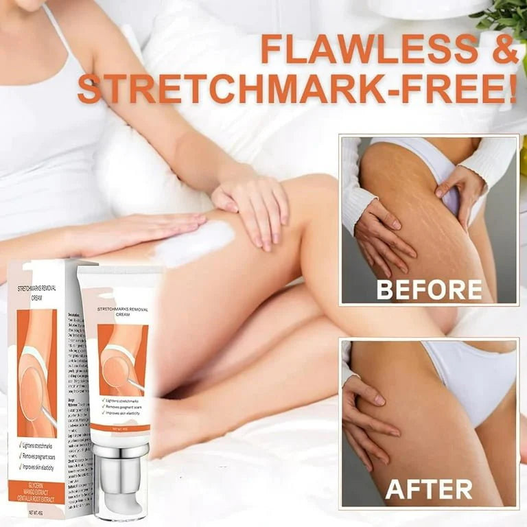 Stretch Marks Removal Repair Cream